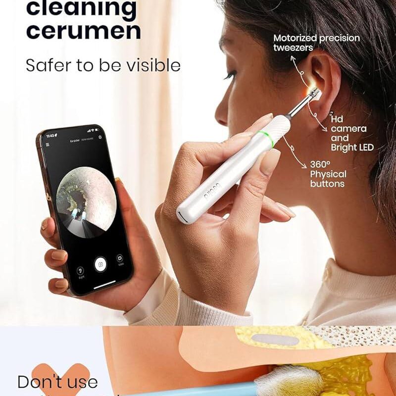 Smart Visual Ear Cleaner with HD Camera and LED – Wireless Otoscope with Tweezers